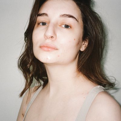 Acne & Blemishes
